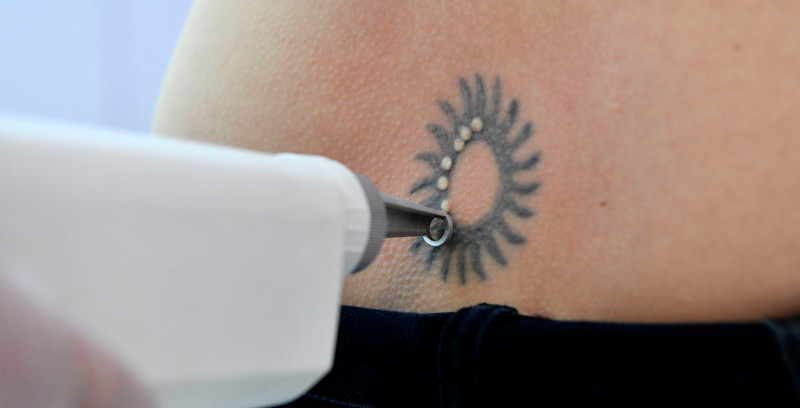 Tattoolos